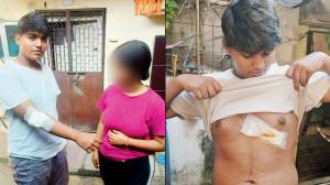 Mumbai: Driver who lands man in hospital turns out to be a ‘drunk’ cop