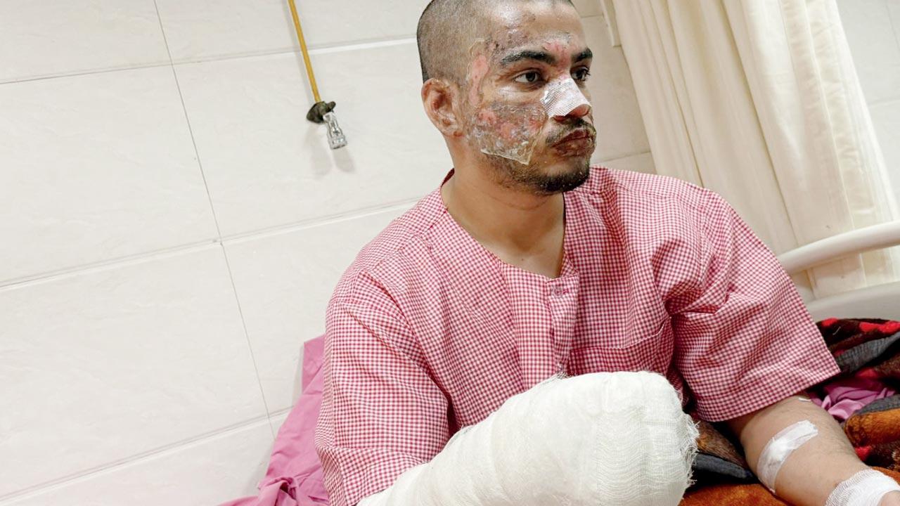 Mumbai Police add attempt to murder, rioting charges in Kurla birthday case