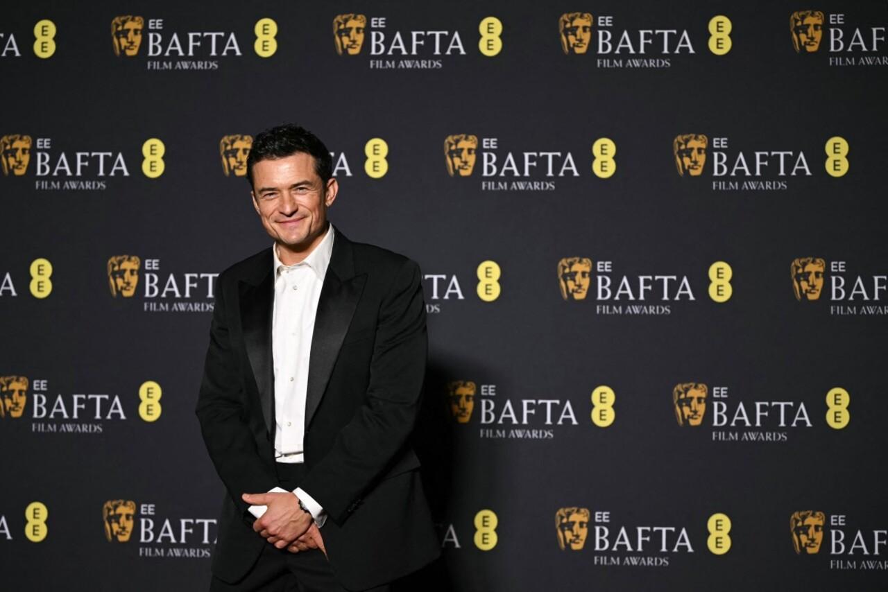 Orlando Bloom as always kept it simple yet stylish for the awards night