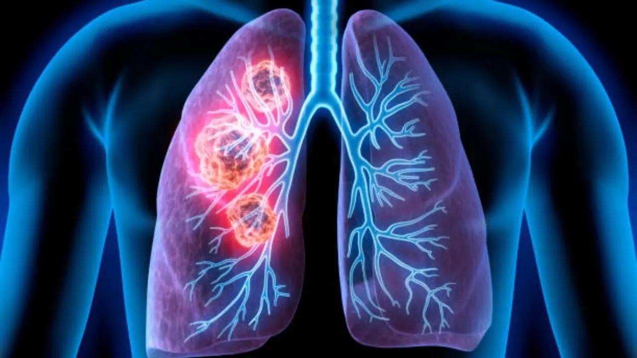 Pollution from car brake-wear more harmful for lungs than diesel exhaust: Study