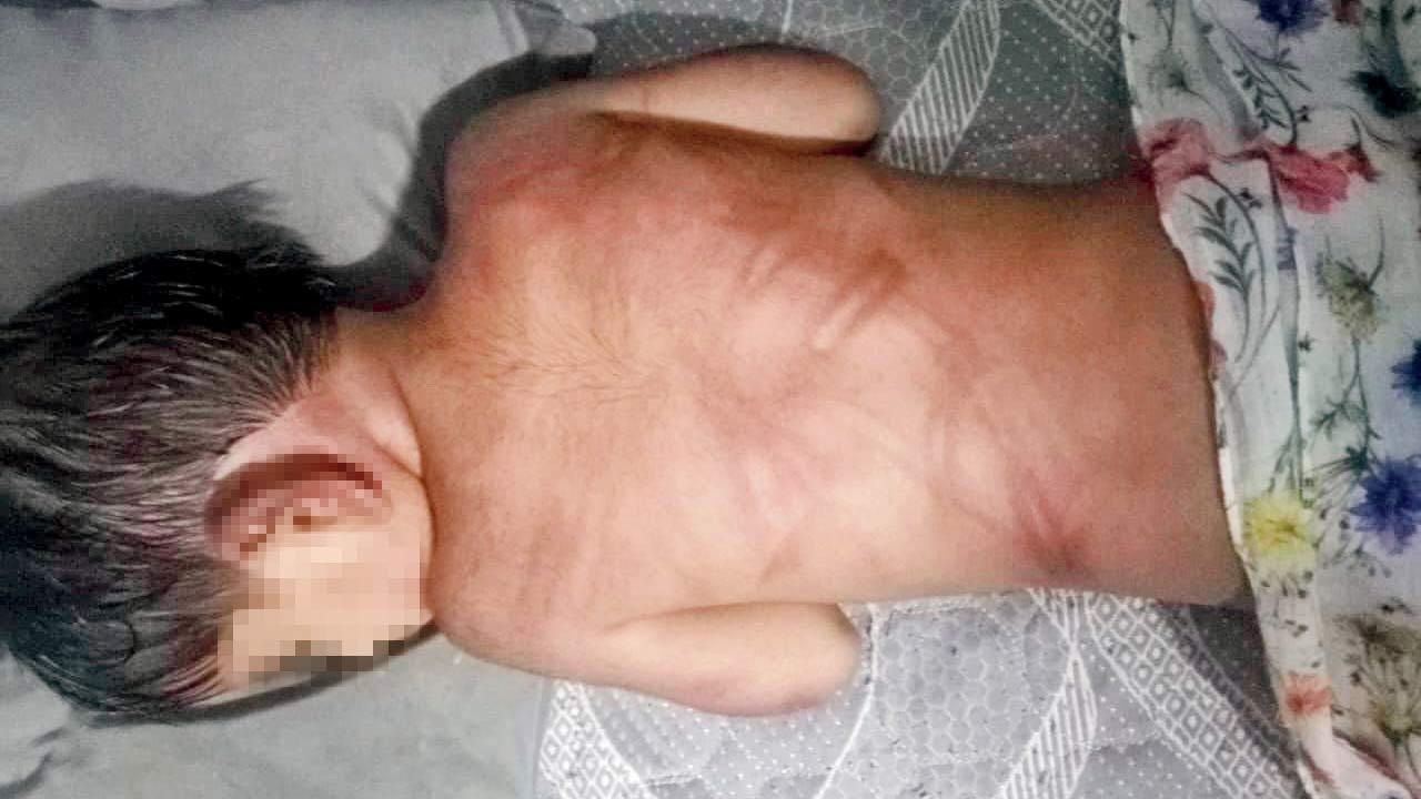 Mumbai: Ghatkopar woman booked for assaulting 3-year-old son