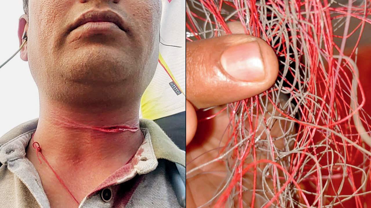 Mumbai: Biker’s neck slashed after getting entangled in kite manja
