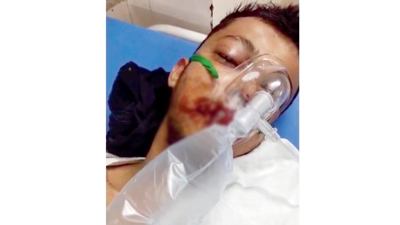 Vipul Rai, who was injured along with the deceased