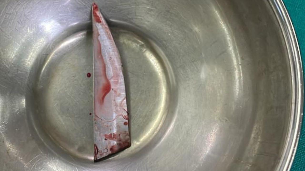 Photo surfaces of broken knife piece removed from Saif’s back after attack