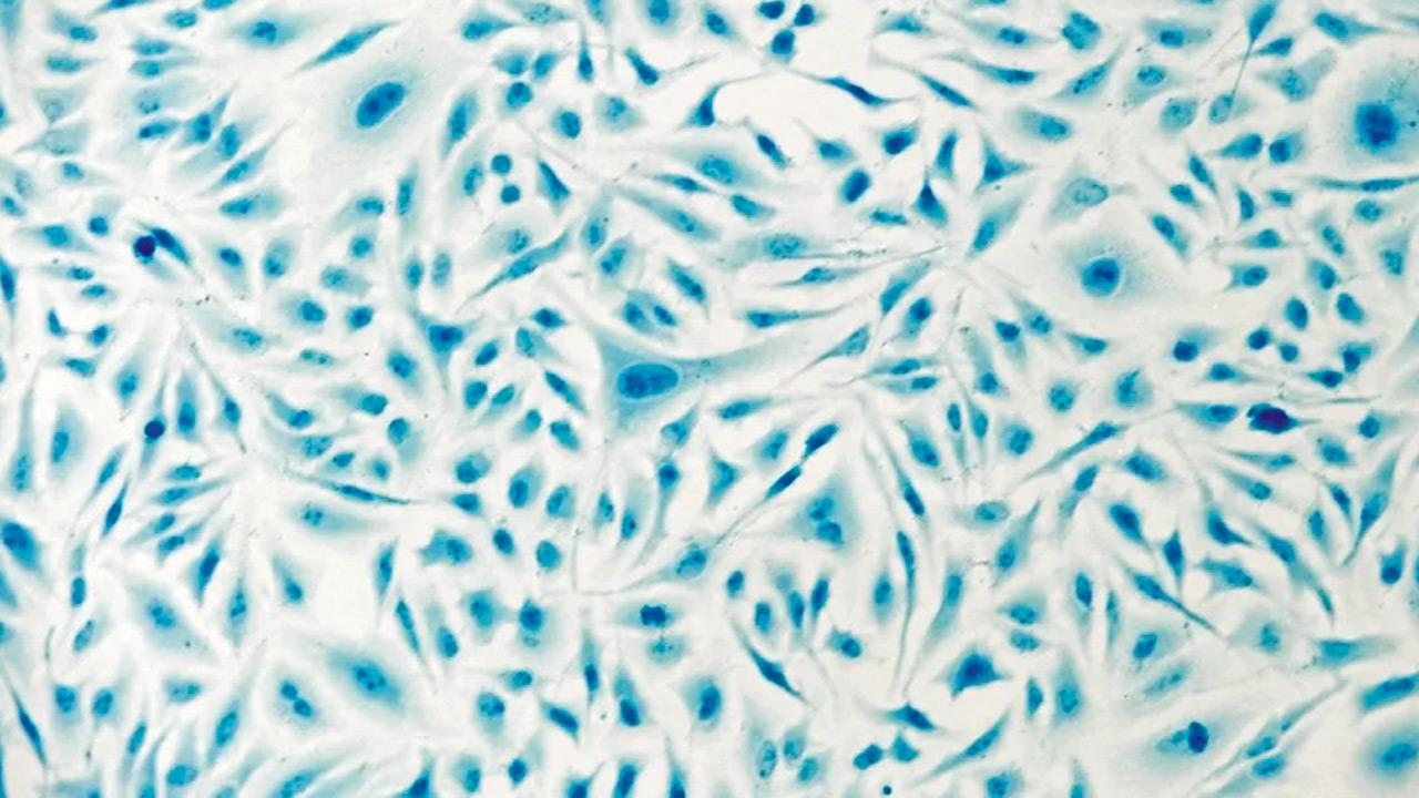 Tiny elephant 3-D printed inside a cell
