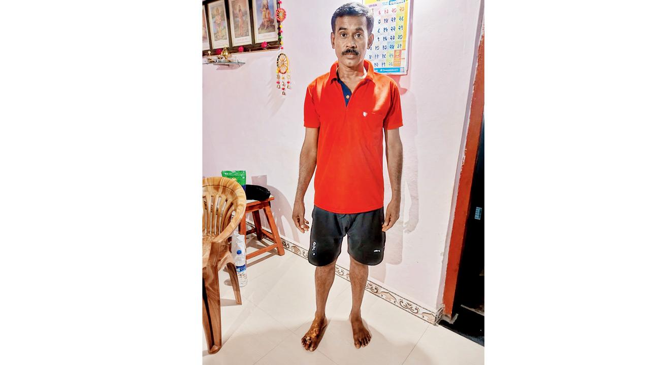 Balu Hanumant Jadhav shows his injured toe, which was cut by falling debris near Kasara station. Pic/Shrikant Khuperkar