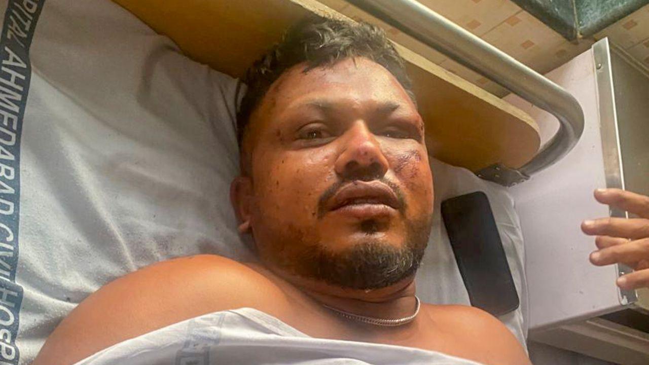 Ahmedabad Plane Crash LIVE Updates: Miracle survivor says 'saw people dying'