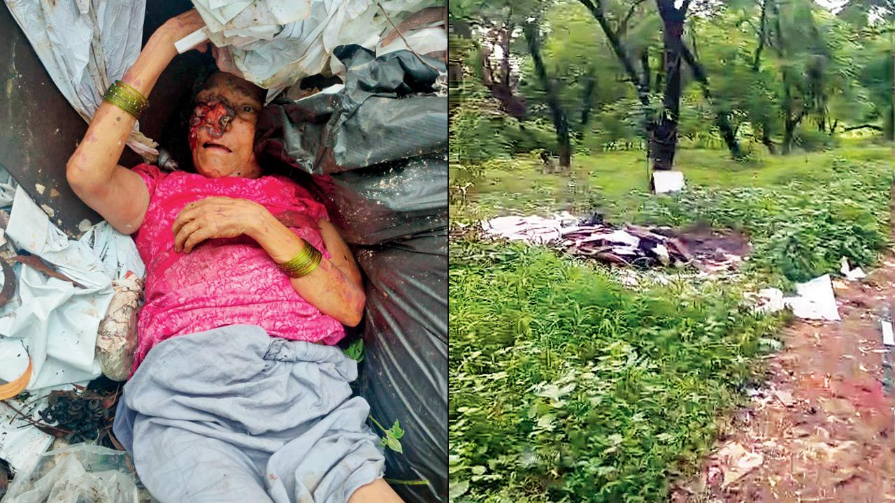 (From left) The abandoned woman found near a garbage dump in Aarey; the roadside garbage dump where the woman was discovered. Pics/By Special Arrangement