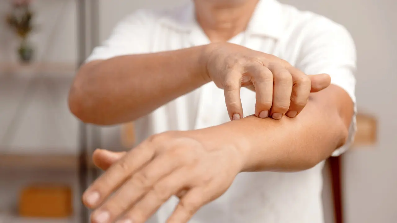 Dermatologists warn of skin issues from daily filth exposure