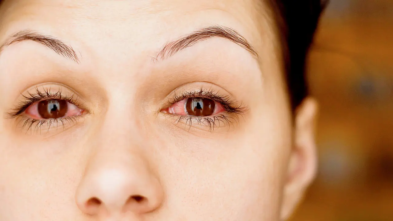 Mumbai: Monsoon eye epidemic round the corner