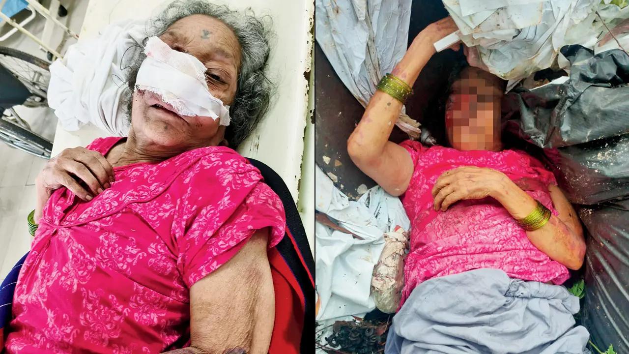 Mid-Day Top News: Abandoned cancer-stricken elder found in Aarey garbage heap