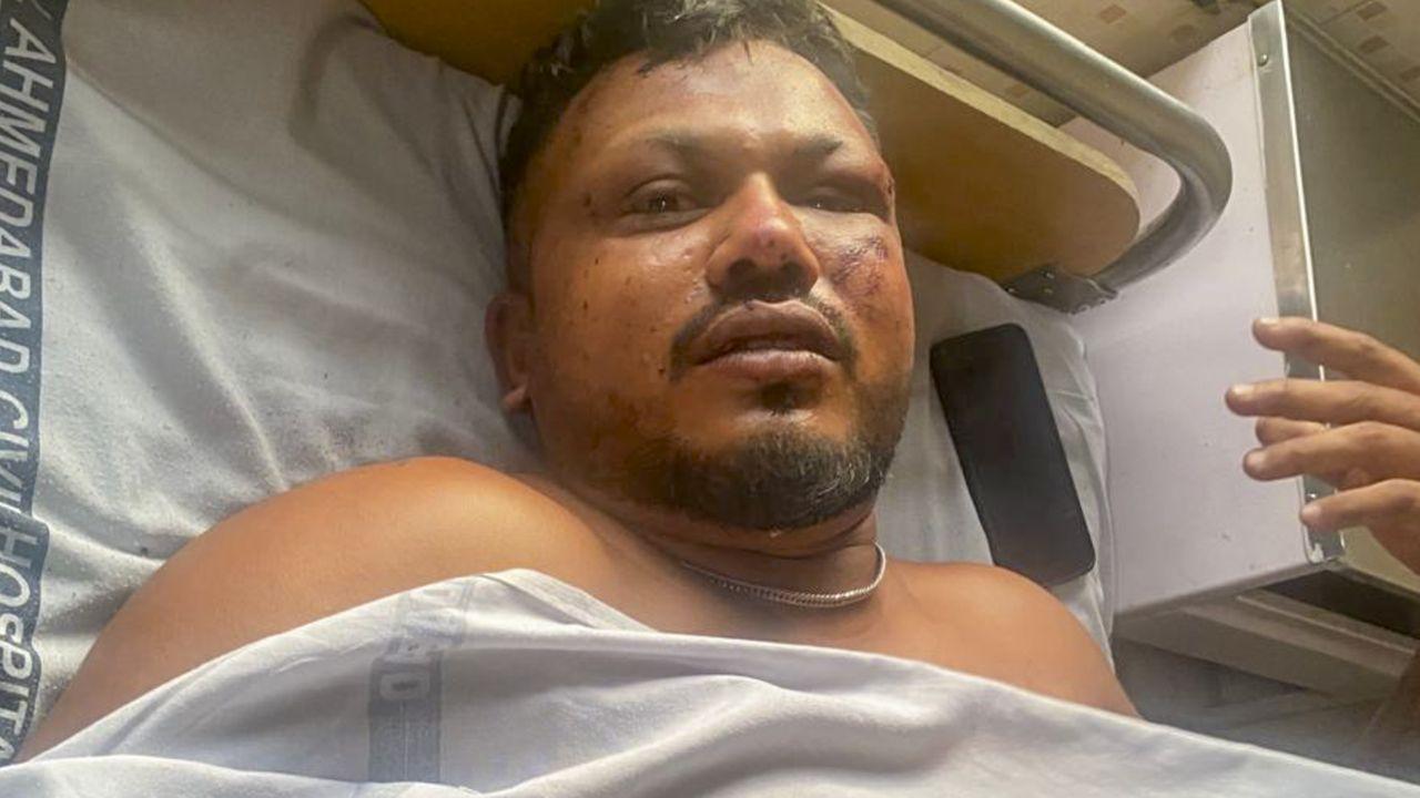 “Can’t believe I survived,” says miracle survivor of Ahmedabad plane crash