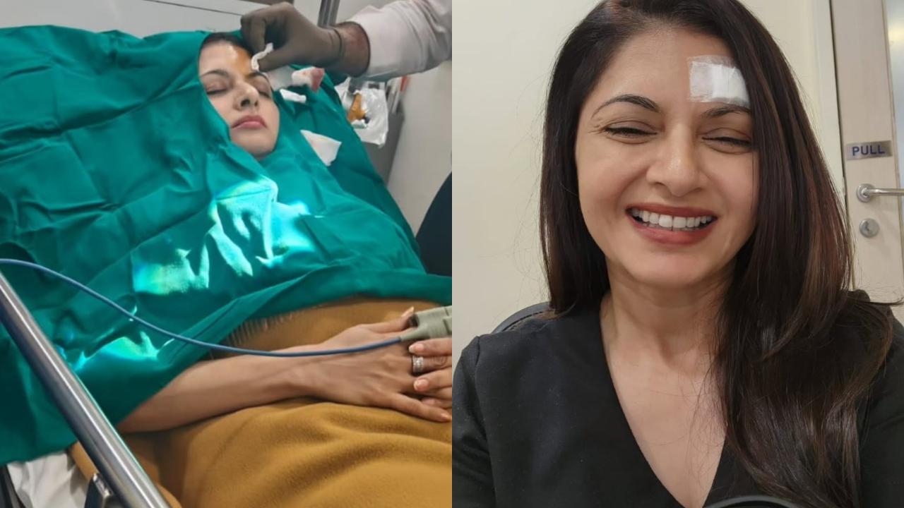 Actress Bhagyashree sustained a deep wound on her forehead while playing pickleball. The actress underwent surgery for the same and got 13 stitches. Read full story here