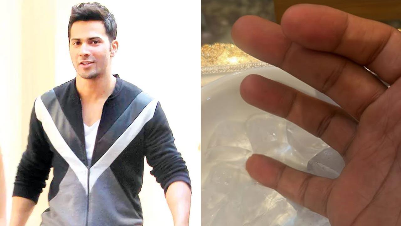 Varun Dhawan gets a ‘work injury’, asks ‘how long it takes to heal’
