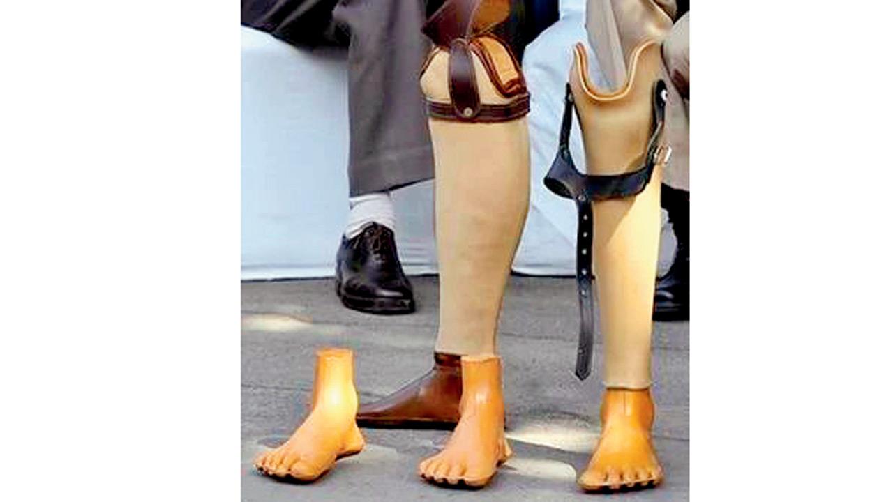India to give 600 artificial limbs to people in Guatemala