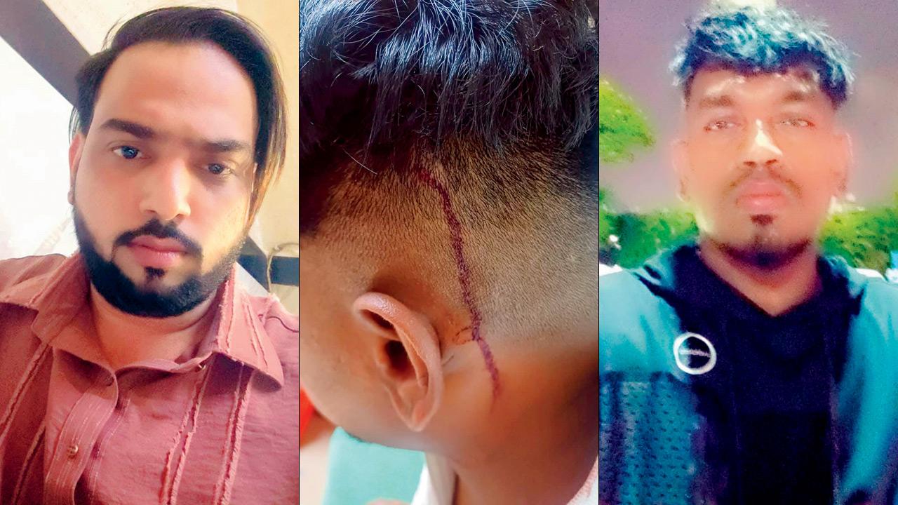 Victim Aslam Pathan; (right) Pathan’s friend Justin D’Souza who was hit on the head by the accused. Pics/BY special arrangement