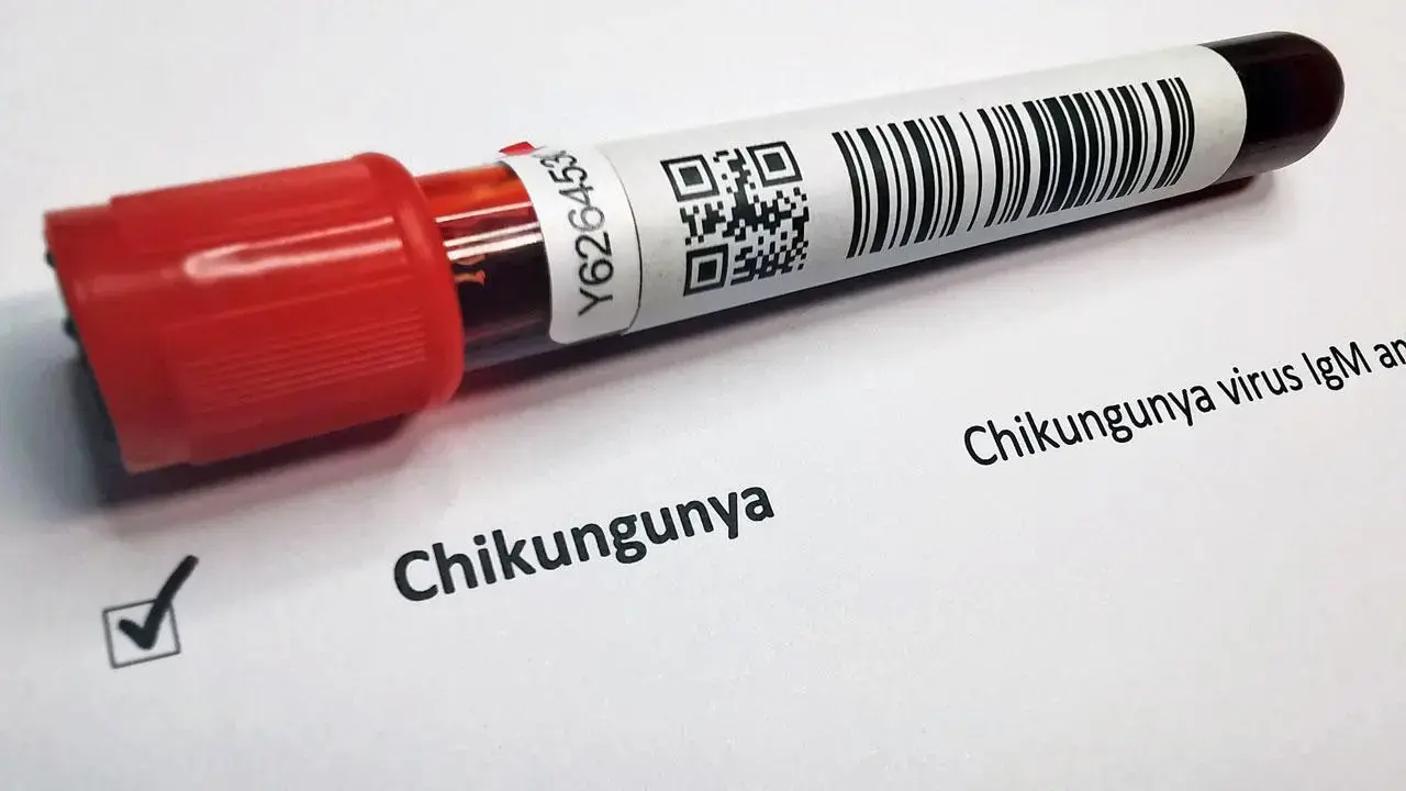 Mumbai LIVE: Chikungunya cases go up by 185 in Maharashtra during Jan-April