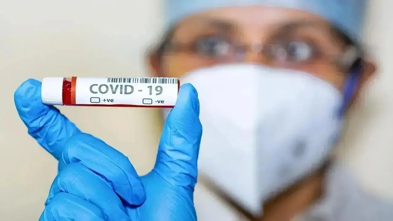 Covid -19: Current infection pressure not severe, however safety measures needed