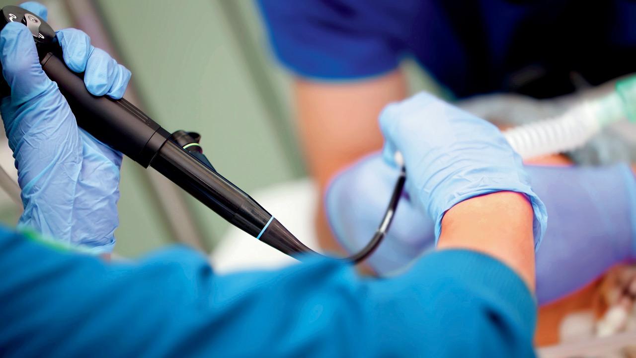 A bronchoscopy revealed two betel nut pieces lodged in the right lower lobe of the lung. Representation pic/istock