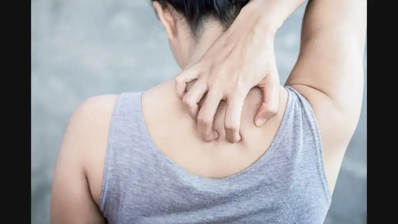 Belly fat may raise risk of psoriasis in women, finds study