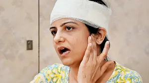 Mumbai: Dentist injured after hammer head falls from construction site in Khar