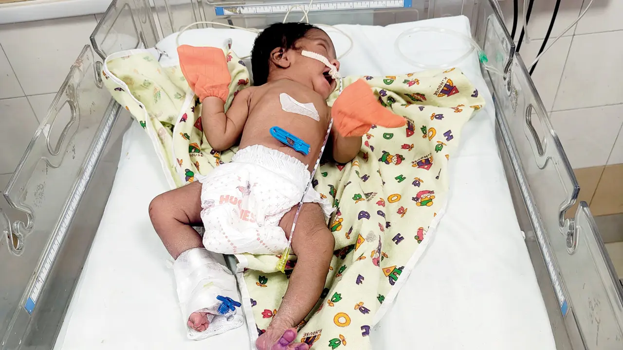 At Shatabdi Hospital, the baby girl is now stable. Pic/Ritika Gondhalekar