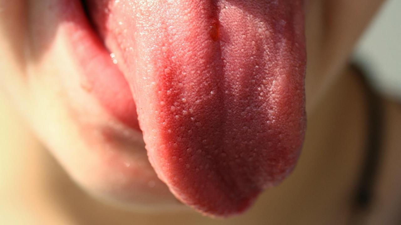 Your tongue may hold clues to detect, track motor neurone disease: Study