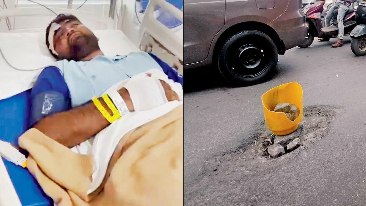 Mumbai | Mid-Day impact: Civic action follows pothole accident; injured student sent home to heal
