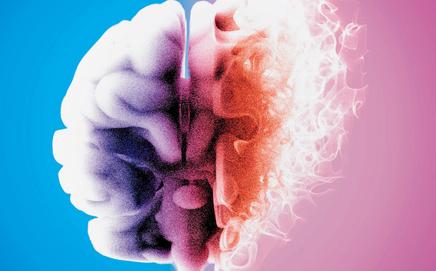 Alzheimer’s degrades the brain. Representation pic/iStock