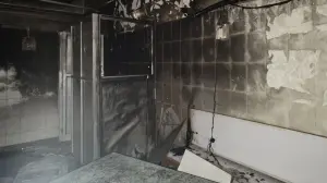 Poor AC maintenance led to explosion in Sion Hospital X-ray unit: Officials