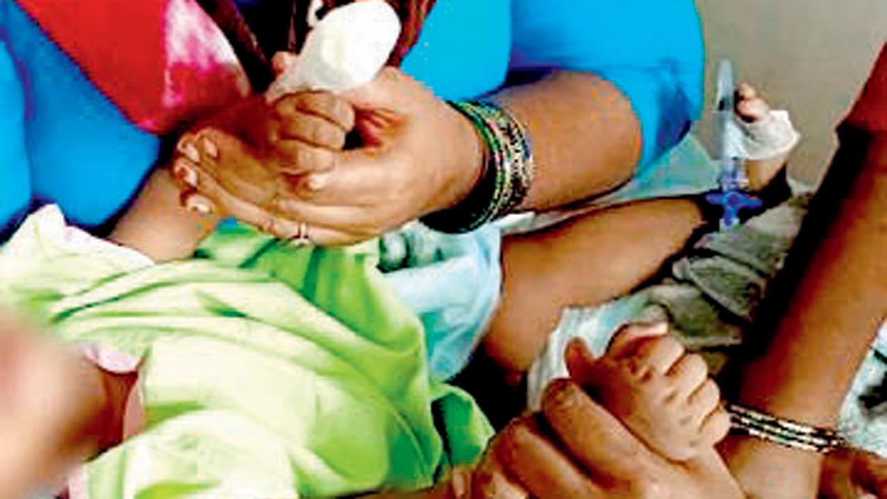 Six-month-old injured during treatment in Bengaluru, hospital faces case
