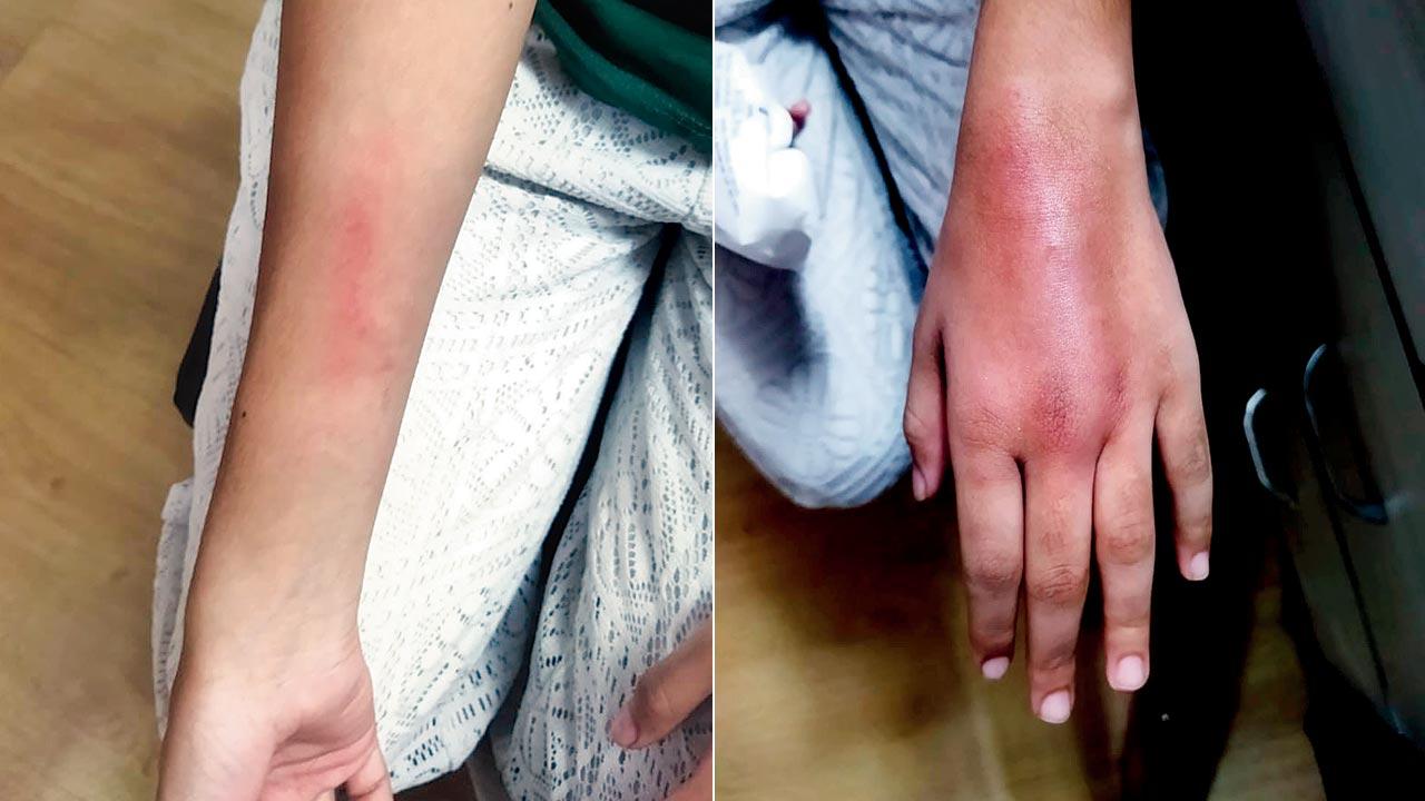 Navi Mumbai tutor booked for allegedly beating 13-year-old student