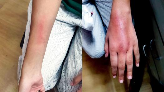 Navi Mumbai tutor booked for allegedly beating 13-year-old student