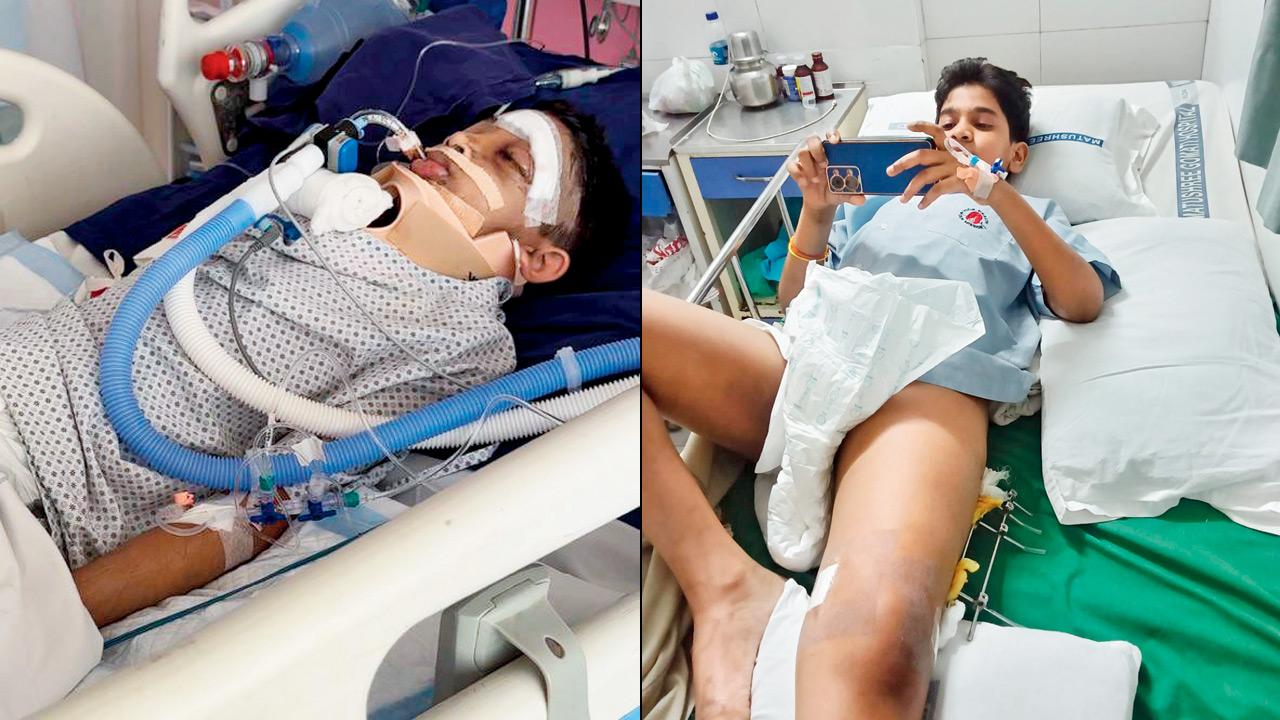 Goregaon lift mishap: One youth critical, other discharged from hospital