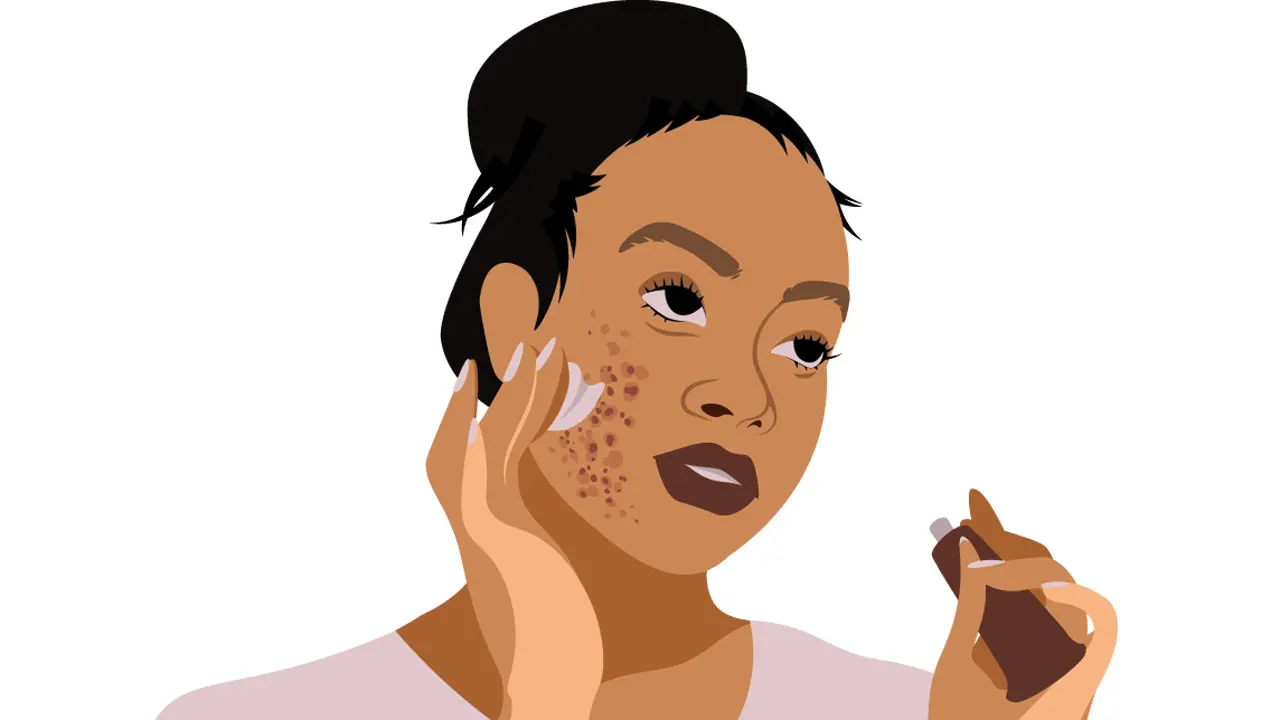 Teen creates unique guide to help burn and acid attack survivors navigate life