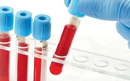 Image for representational purpose only. Photo Courtesy: File pic