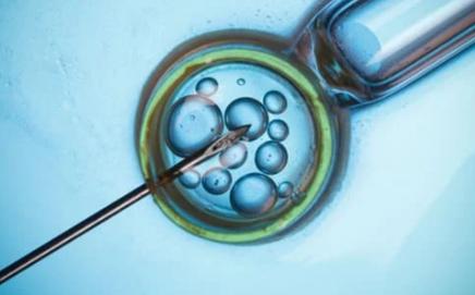 Representational Pic