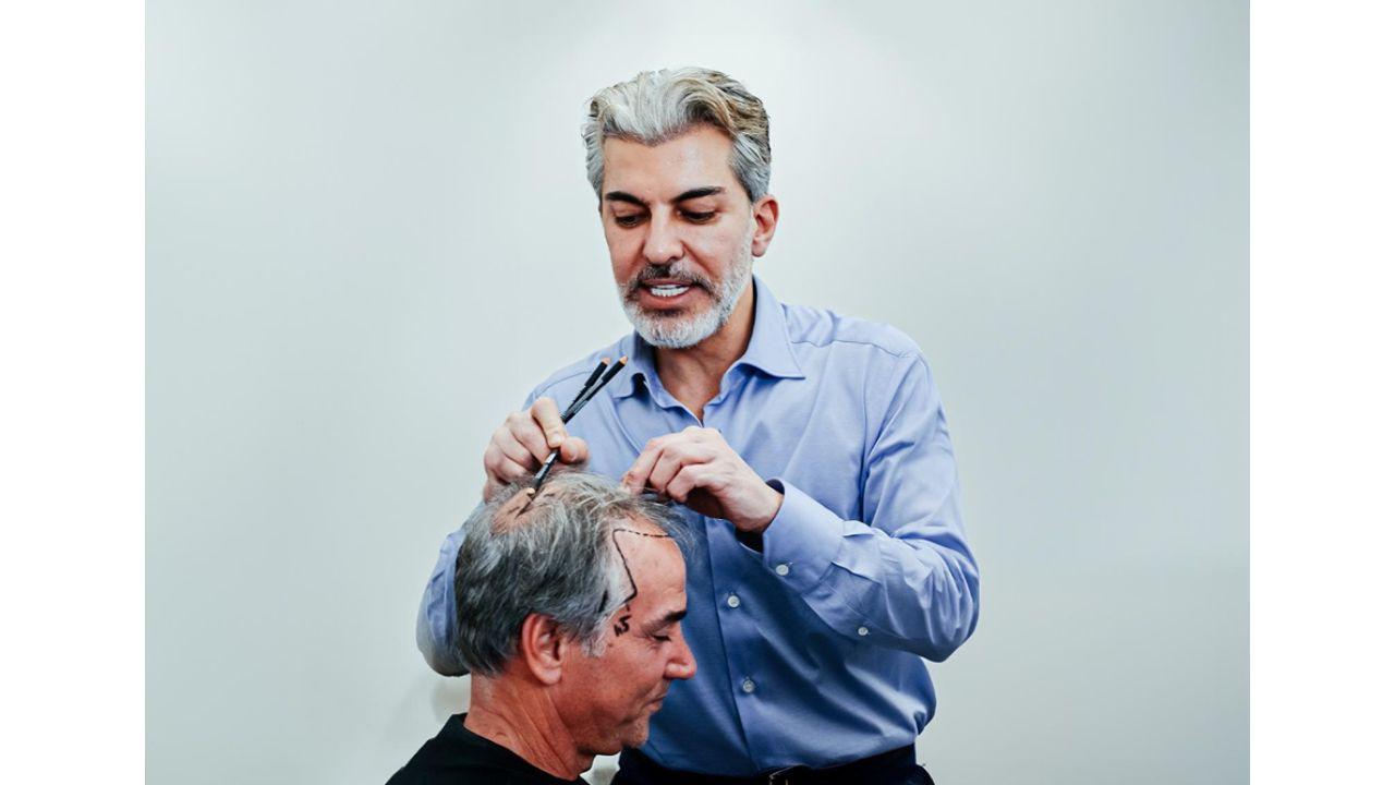 Definitive Ranking of the Hair Transplant in Turkey 2026