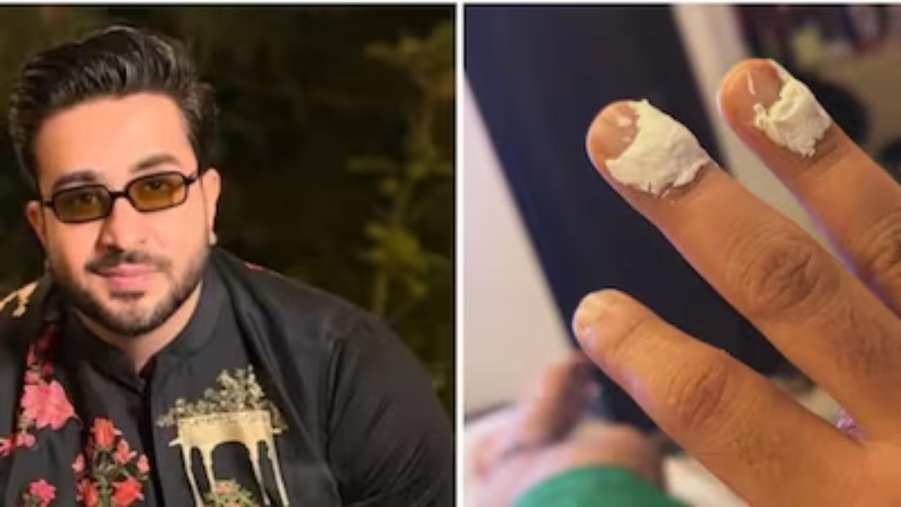 Aly Goni burns his fingers while frying pakode on the sets of Laughter Chefs 3