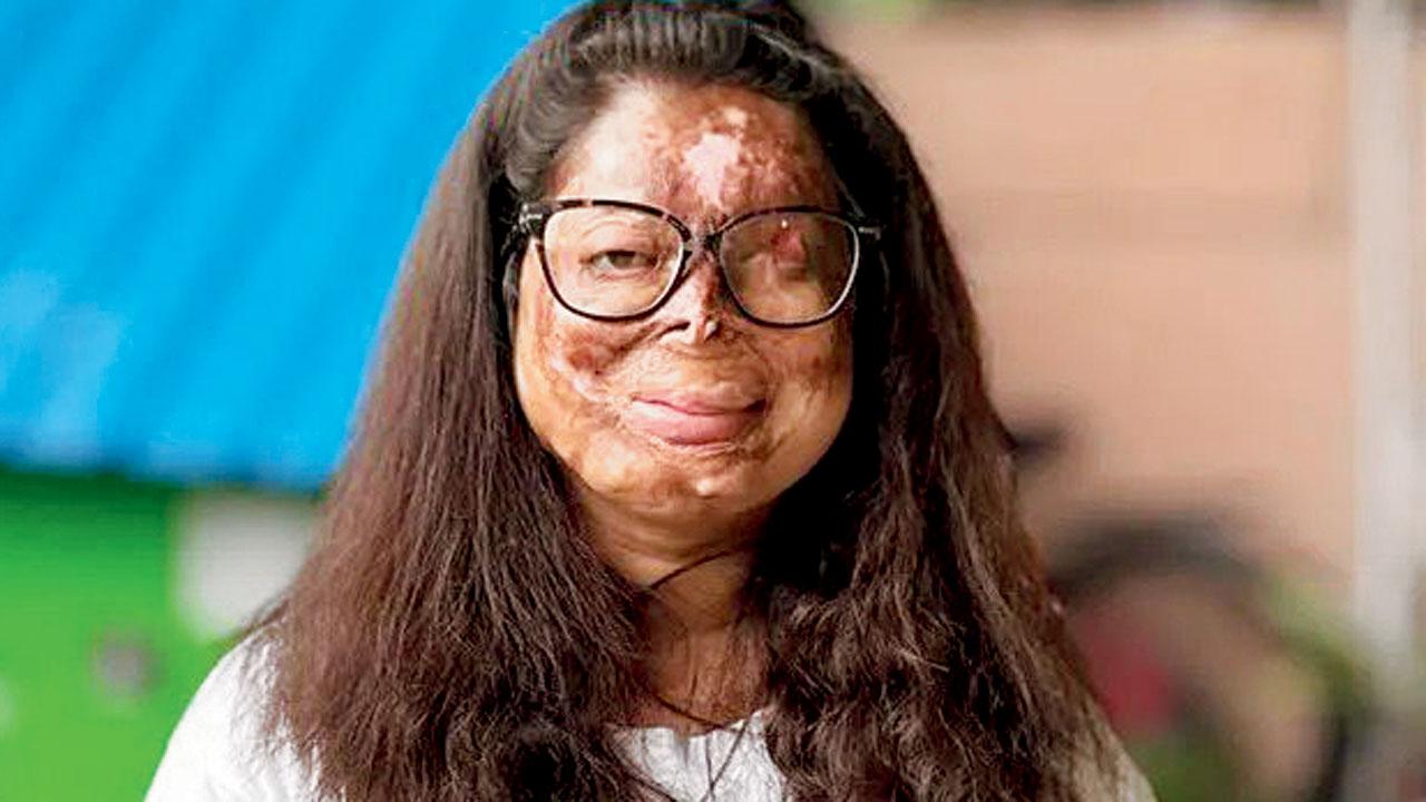 Coming from a village, Anshu, an acid attack survivor, said she had no knowledge of skincare routines or which products were safe