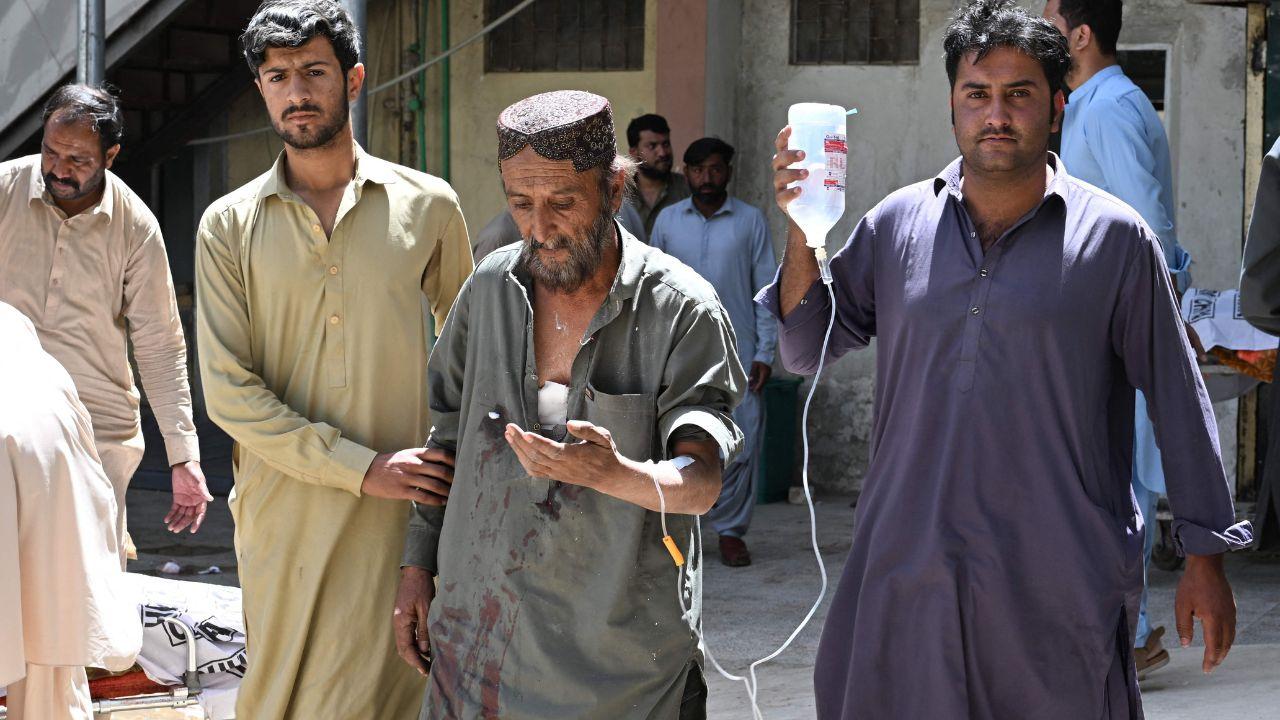 Injured passengers, many covered in blood and dust, are carried on stretchers as emergency responders rush them to nearby hospitals Injured passengers, many covered in blood and dust, are carried on stretchers as emergency responders rush them to nearby hospitals