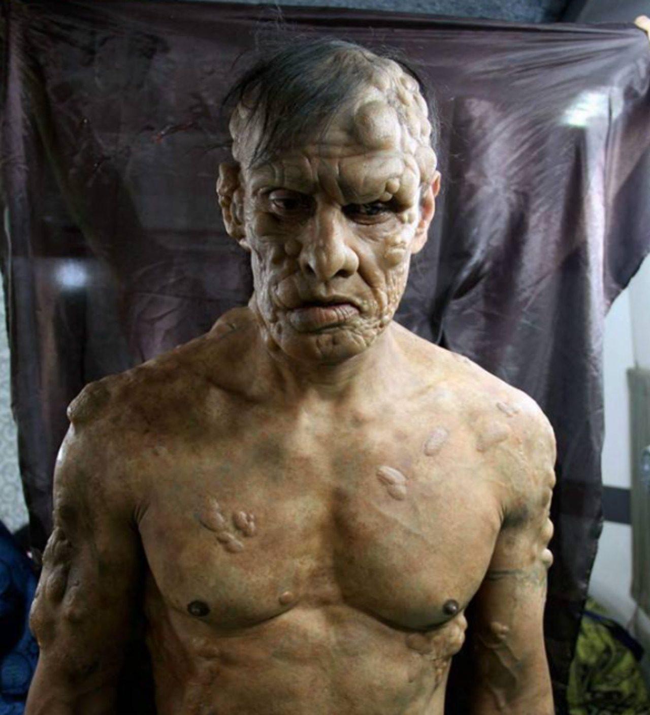 Chiyaan Vikram sported a jaw-dropping, highly grueling prosthetic look as Lingesan in I (2015). Chiyaan Vikram sported a jaw-dropping, highly grueling prosthetic look as Lingesan in I (2015).
