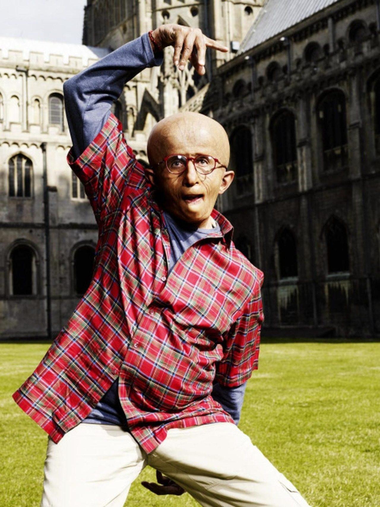Amitabh Bachchan's trasformation as Auro, a 12-year-old boy suffering from the rare genetic aging disorder progeria, in the film Paa (2009) is still regarded as one of Indian cinema's most groundbreaking transformations. Amitabh Bachchan's trasformation as Auro, a 12-year-old boy suffering from the rare genetic aging disorder progeria, in the film Paa (2009) is still regarded as one of Indian cinema's most groundbreaking transformations.