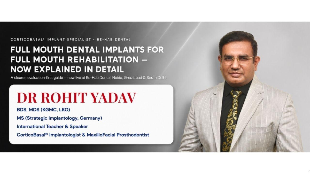 Full Mouth Dental Implants.