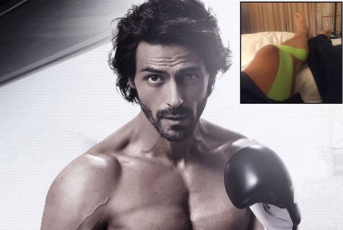 Bollywood actor Arjun Rampal injured his knee while filming `Kahaani 2`, which also starred Vidya Balan. Arjun was shooting a chase sequence when he `busted` his knee. He also shared a photograph of his injury on Twitter. (Photo inset: Courtesy Arjun Rampal`s Twitter account) Bollywood actor Arjun Rampal injured his knee while filming `Kahaani 2`, which also starred Vidya Balan. Arjun was shooting a chase sequence when he `busted` his knee. He also shared a photograph of his injury on Twitter. (Photo inset: Courtesy Arjun Rampal`s Twitter account)