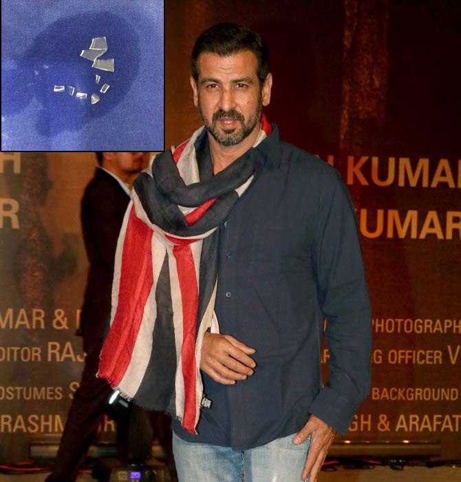 Actor Ronit Roy had to undergo surgery after he suffered an injury while shooting an action sequence for `Kaabil`. He is now back home and recovering. Ronit said the surgery went well and nine pieces of glass were removed from his arm. (Photo inset: Courtesy Ronit Roy`s Twitter account) The actor had delayed the surgery by 24 hours to complete the shoot. `Kaabil` director Sanjay Gupta lauded Ronit`s dedication towards his work and tweeted, `Dedication to work. Ronit Roy severely hurt his arm in an action sequence in `Kaabil` and delayed surgery by 24 hours to complete the shoot.` Actor Ronit Roy had to undergo surgery after he suffered an injury while shooting an action sequence for `Kaabil`. He is now back home and recovering. Ronit said the surgery went well and nine pieces of glass were removed from his arm. (Photo inset: Courtesy Ronit Roy`s Twitter account) The actor had delayed the surgery by 24 hours to complete the shoot. `Kaabil` director Sanjay Gupta lauded Ronit`s dedication towards his work and tweeted, `Dedication to work. Ronit Roy severely hurt his arm in an action sequence in `Kaabil` and delayed surgery by 24 hours to complete the shoot.`