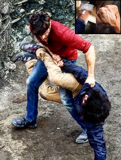 Sidharth Malhotra got injured while shooting an action scene for A Gentleman with Jacqueline Fernandez. The `Baar Baar Dekho` actor took to Instagram to share a photo of his bruised hand and leg and captioned it, `No Pain No Gain! #action #shoot (sic).` Pic/Sidharth Malhotra`s Instagram account Sidharth Malhotra got injured while shooting an action scene for A Gentleman with Jacqueline Fernandez. The `Baar Baar Dekho` actor took to Instagram to share a photo of his bruised hand and leg and captioned it, `No Pain No Gain! #action #shoot (sic).` Pic/Sidharth Malhotra`s Instagram account
