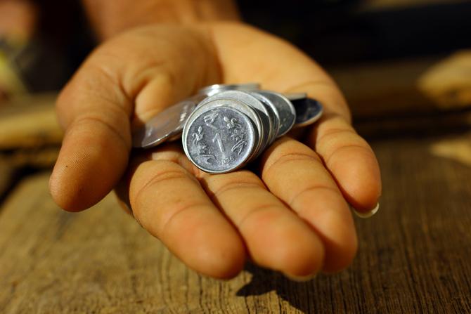 A rare surgery was performed in Madhya Pradesh's Rewa district, where doctors removed 5 kilograms of iron objects including a chain, 263 coins and shaving blades, from the stomach of a man. The operation was performed at the Sanjay Gandhi Medical College and Hospital