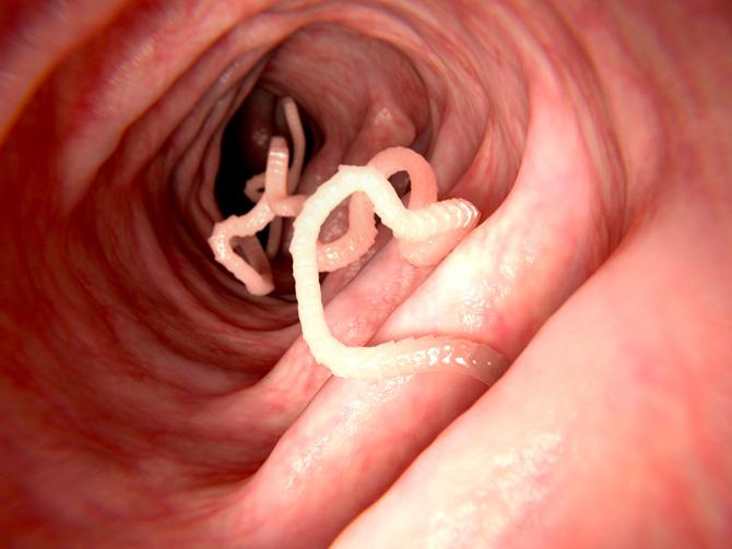 Doctors from the Institute of Liver and Biliary Sciences Hospital in New Delhi successfully removed a 6-foot long tapeworm from the mouth of a 48-year-old patient. The doctors used forceps to remove the parasite. Even the doctors expressed surprise at how long the worm was.